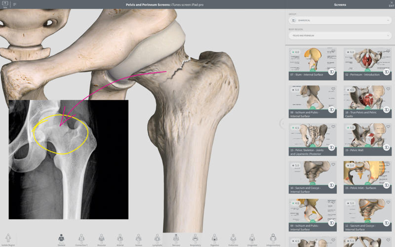 4_Complete_Anatomy_2018.jpg