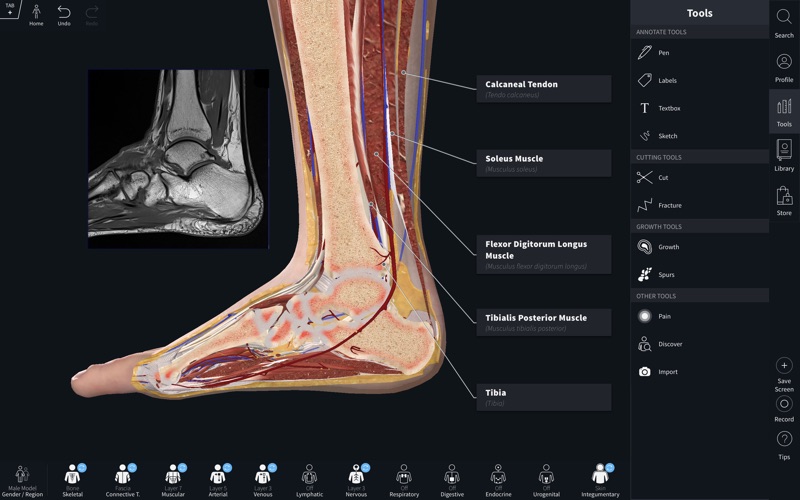 4_Complete_Anatomy_2019.jpg