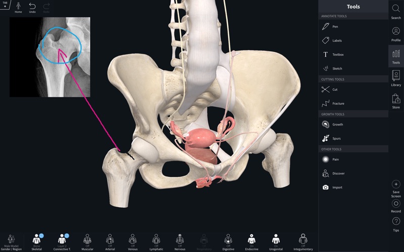 5_Complete_Anatomy_2019.jpg